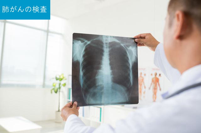 肺がんの検査