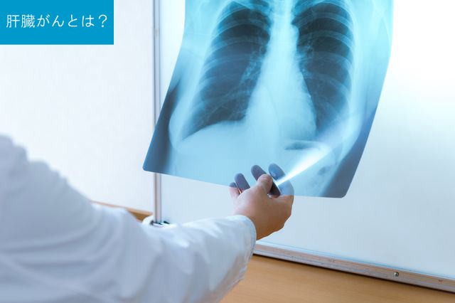 肝臓がんとは