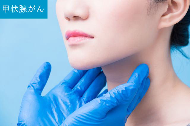 甲状腺がんとは
