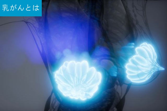 乳がんとは