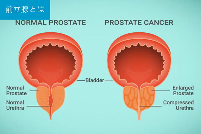 前立腺とは