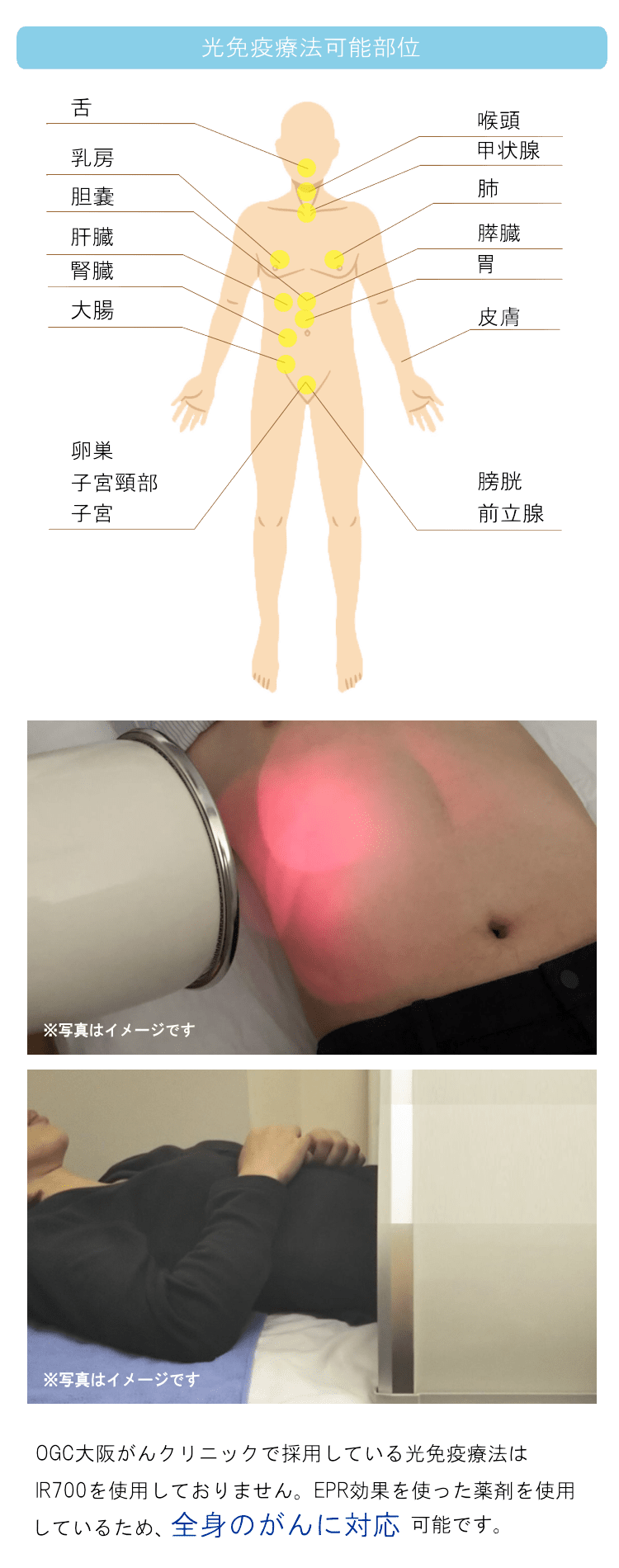 TGCの光免疫療法は全身に対応